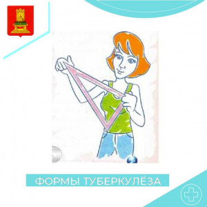 Формы туберкулеза